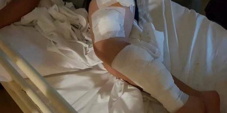 Εξιτήριο παίρνει ο 9χρονος μαθητής που δέχτηκε επίθεση από σκυλιά