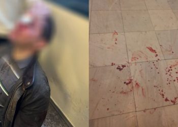 Άγριο «ξυλίκι» στη Νομική Αθηνών – ΦΩΤΟ