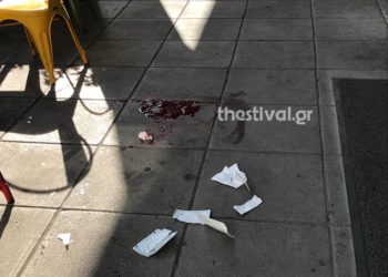 Θεσσαλονίκη: Αιματηρό επεισόδιο με αλλοδαπό που επιχείρησε να κλέψει πορτοφόλι (Φωτογραφίες)