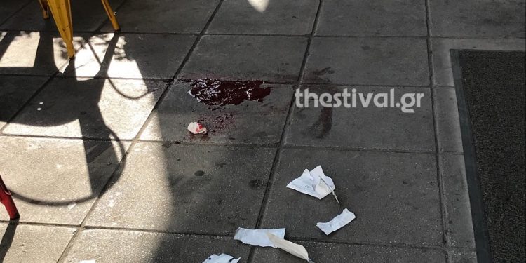 Θεσσαλονίκη: Αιματηρό επεισόδιο με αλλοδαπό που επιχείρησε να κλέψει πορτοφόλι (Φωτογραφίες)
