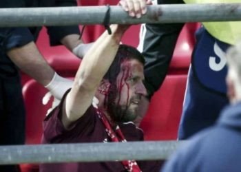 Eπεισοδιακό το… pregame Ολυμπιακός – Μπάγερν με συμπλοκές και τραυματισμούς