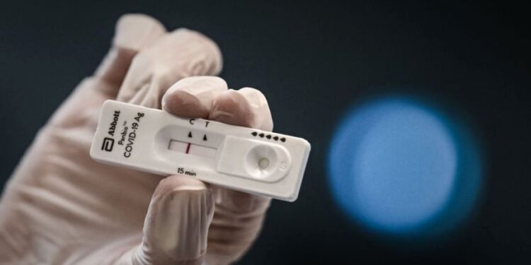 Δωρεάν rapid test κορωνοϊού για τα μέλη της Ένωσης Αθηνών