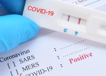 ΠΟΑΞΙΑ: Self-test κορωνοϊού και στο προσωπικό της Ελληνικής Αστυνομίας