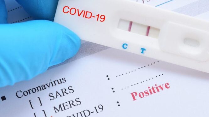 ΠΟΑΞΙΑ: Self-test κορωνοϊού και στο προσωπικό της Ελληνικής Αστυνομίας