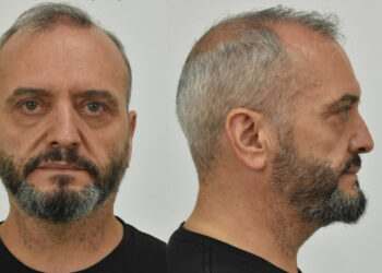 Δεν έχουν τέλος οι αποκαλύψεις για τους βιαστές της 12χρονης στα Σεπόλια