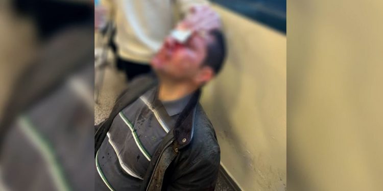 Επεισόδια στη Νομική: Οι 7 προσαγωγές μετατράπηκαν σε έξι συλλήψεις