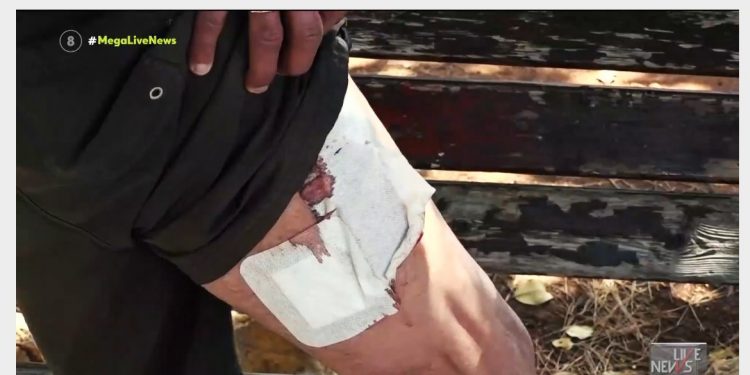 Βουλιαγμένη: Τρίτη φορά που επιτίθεται ο σκύλος της οικογένειας Τσιτσιπά