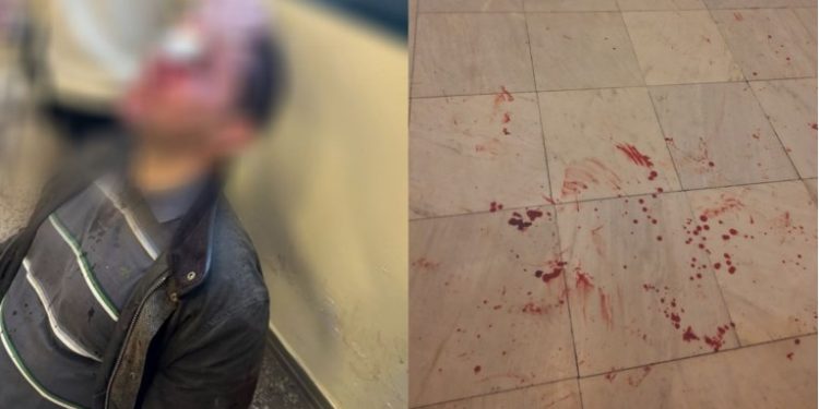 Άγριο «ξυλίκι» στη Νομική Αθηνών – ΦΩΤΟ