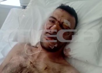 Μυτιλήνη: 32χρονος μαχαίρωσε… 18 φορές έναν 35χρονο σε πανηγύρι – Το ποινικό παρελθόν του – ΒΙΝΤΕΟ