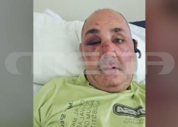 Ρόδος: Του άδειασαν το κοσμηματοπωλείο αφού τον ξυλοκόπησαν άγρια – ΒΙΝΤΕΟ – ΦΩΤΟ