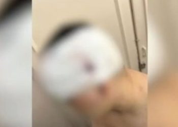 Σοκαριστική επίθεση συμμορίας κουκουλοφόρων σε 13χρονο – Του επιτέθηκαν με ξύλα – ΒΙΝΤΕΟ – ΦΩΤΟ