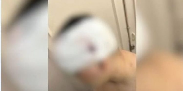 Σοκαριστική επίθεση συμμορίας κουκουλοφόρων σε 13χρονο – Του επιτέθηκαν με ξύλα – ΒΙΝΤΕΟ – ΦΩΤΟ