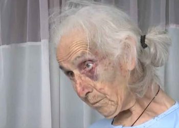 Αγρίνιο: Αδίστακτοι ληστές ξυλοκόπησαν άγρια 85χρονη στο σπίτι της για… 100 ευρώ – ΒΙΝΤΕΟ