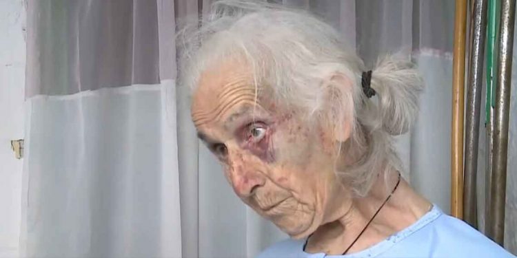 Αγρίνιο: Αδίστακτοι ληστές ξυλοκόπησαν άγρια 85χρονη στο σπίτι της για… 100 ευρώ – ΒΙΝΤΕΟ