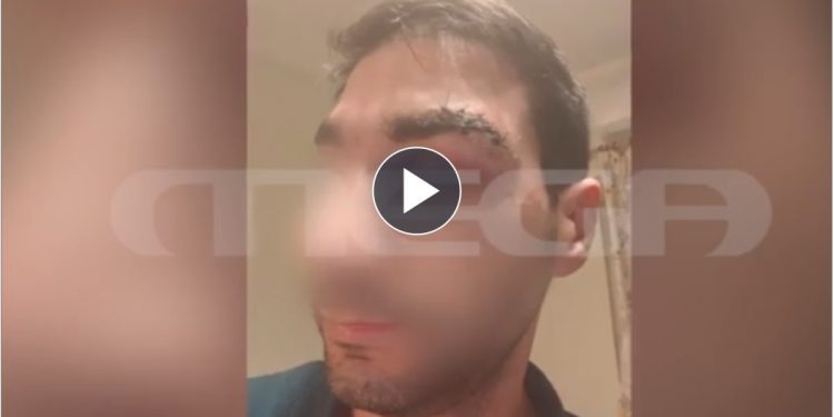 Νεκρός 44χρονος ασθενής που ξυλοκόπησε γιατρό μέσα στο νοσοκομείο στο Αίγιο – ΒΙΝΤΕΟ